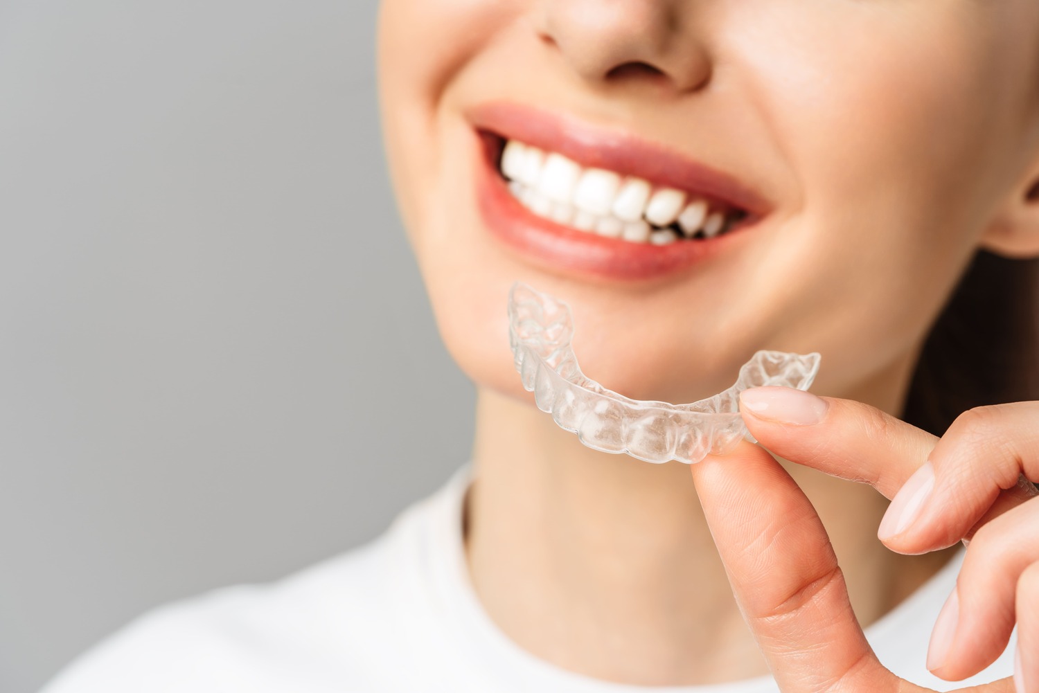 Invisalign Bergschenhoek